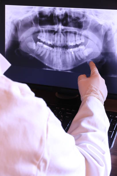 Best Knocked-Out Tooth (Avulsed Tooth) Treatment in August, CA